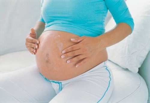 профилактика варикозного расширения вен во время беременности